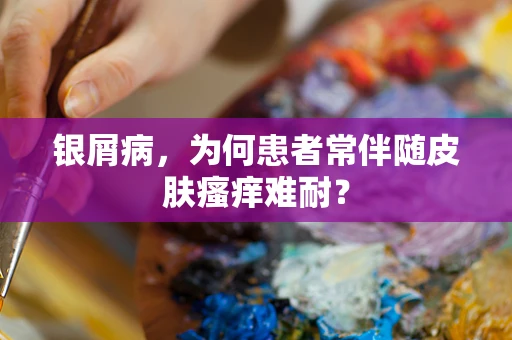 银屑病，为何患者常伴随皮肤瘙痒难耐？