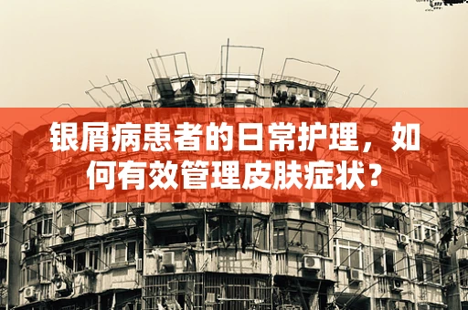 银屑病患者的日常护理，如何有效管理皮肤症状？