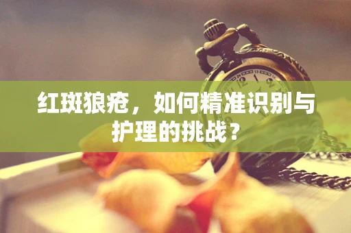 红斑狼疮，如何精准识别与护理的挑战？