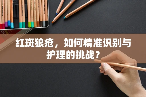 红斑狼疮，如何精准识别与护理的挑战？