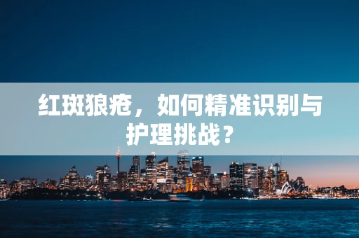 红斑狼疮，如何精准识别与护理挑战？