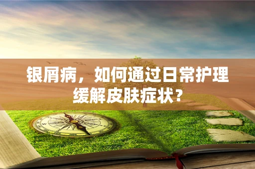 银屑病，如何通过日常护理缓解皮肤症状？