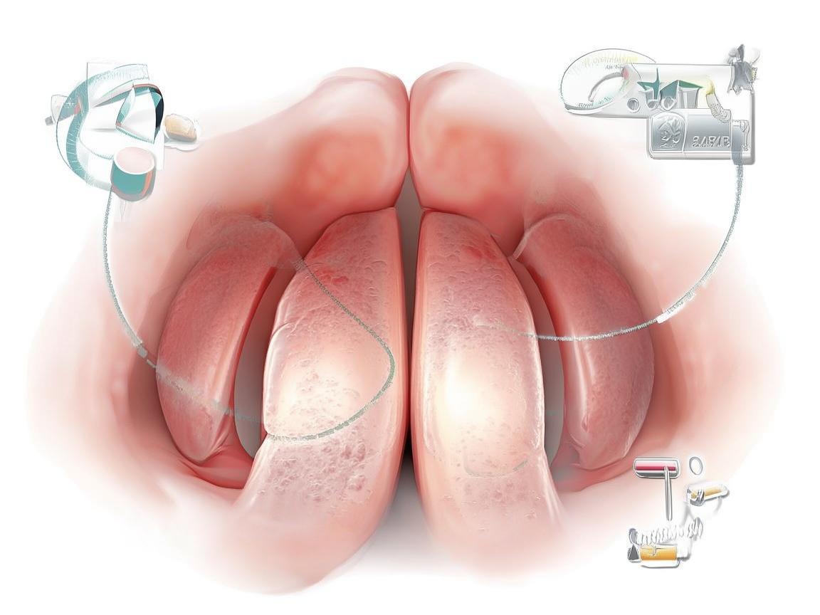 扁桃体炎，如何区分急性与慢性，选择恰当的护理策略？
